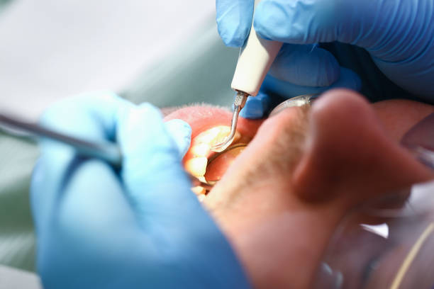Best Emergency Orthodontic Repairs in Falconer, NY