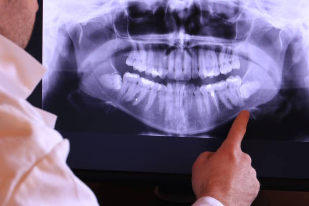 Best Walk-In Emergency Dentist in Falconer, NY
